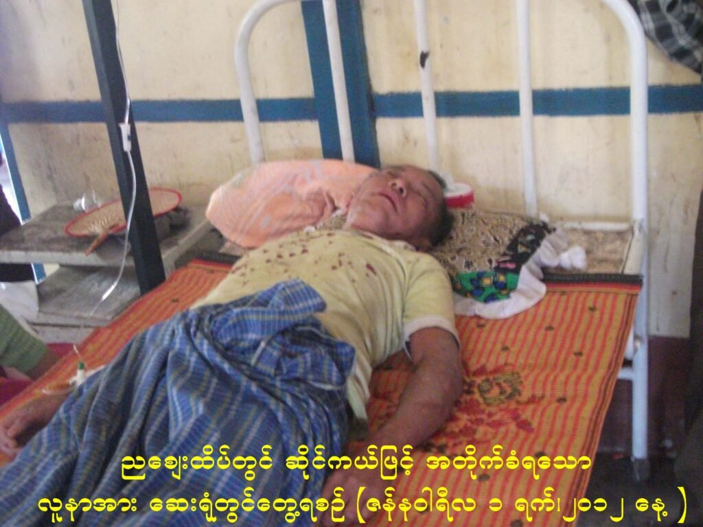 တောင်ကုတ်မြို့ ညဈေးလမ်းထိပ်တွင် ဆိုင်ကယ်တိုက်မှုများ မကြာခဏ ဖြစ်ပေါ်နေ