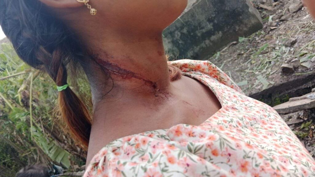 အမျိုးသမီးများနှင့် ကလေးငယ်များသည် လက်ရှိ တိုက်ပွဲများအတွင်း အဓိက မြေစာပင် ဖြစ်နေရပြီး အထိအခိုက်ခံရအများဆုံးသူများဖြစ်နေ